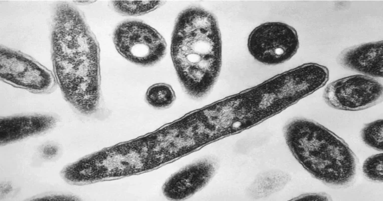 92 Kasus Terkonfirmasi Terinfeksi Wabah Legionnaires di Klaster New York City, Penyakit Apakah Itu?
