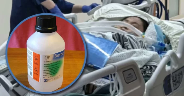 Seorang Wanita di Tiongkok Meninggal Dunia Akibat Gagal Organ Setelah Menginjak Asam Fluorida Saat Berjalan-jalan