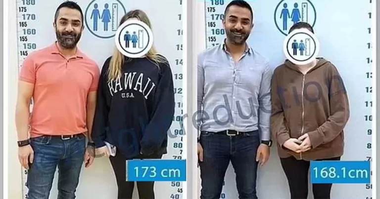 Wanita Menjalani Operasi Pemendekan Anggota Badan untuk Meningkatkan Peluang Menemukan Cinta