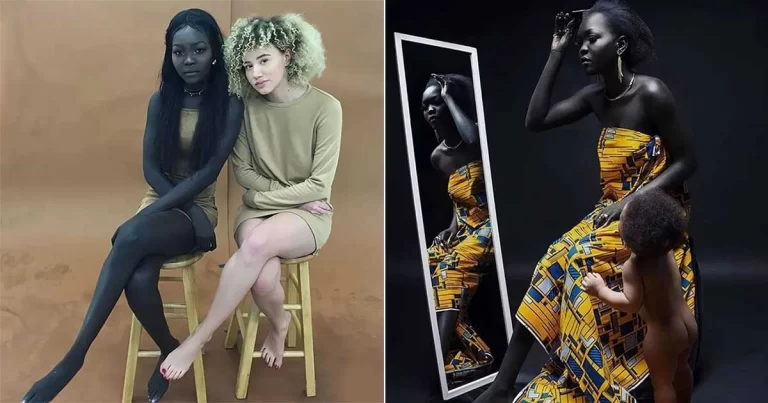 Ratu Kegelapan: Nyakim Gatwech, Sang Dewi Melanin dari Afrika