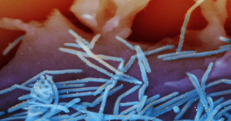 Virus RSV di Tiongkok Mengalami Lonjakan Kasus, Belum Ada Pengobatan yang Efektif
