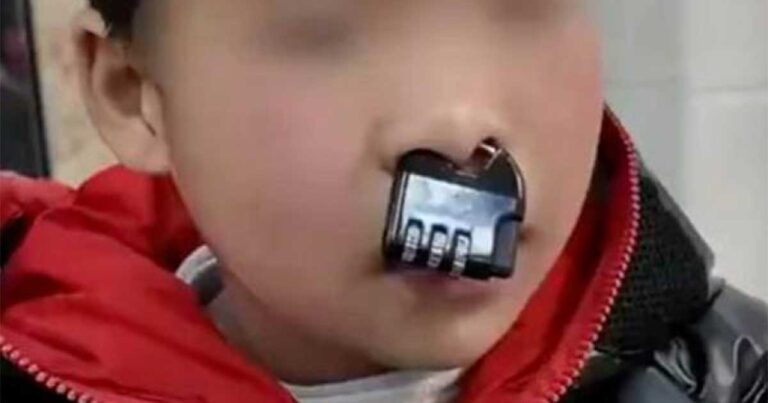 Anak Nakal Terjebak Gembok Kombinasi di Hidungnya