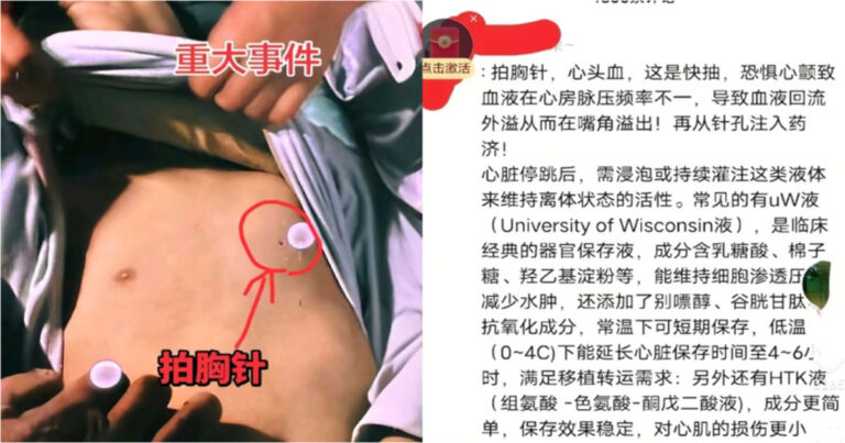 Apakah Kematian Seorang Siswi SMP di Henan, Tiongkok  terkait dengan Perdagangan Organ? Laporan Resmi Pemerintah Justru Memicu Meluasnya Keraguan Publik 