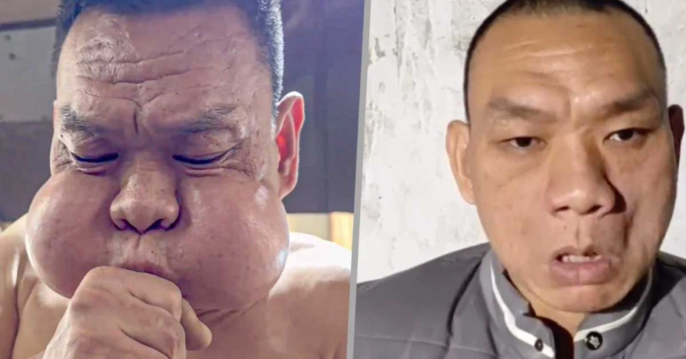 Seorang Peniup Kaca Asal Tiongkok, yang Dijuluki ‘Pangeran Katak’, Memiliki Pipi yang Menonjol Secara Tidak Biasa Setelah 30 Tahun Bekerja