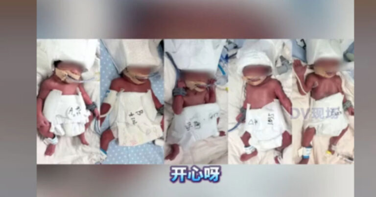 Seorang Perempuan Berusia 24 Tahun di Tiongkok Melahirkan Bayi Kembar Lima